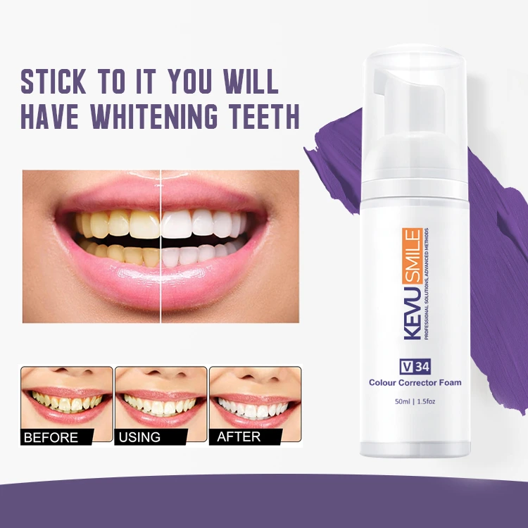 6-kevu-smile-before-after-whitening-results